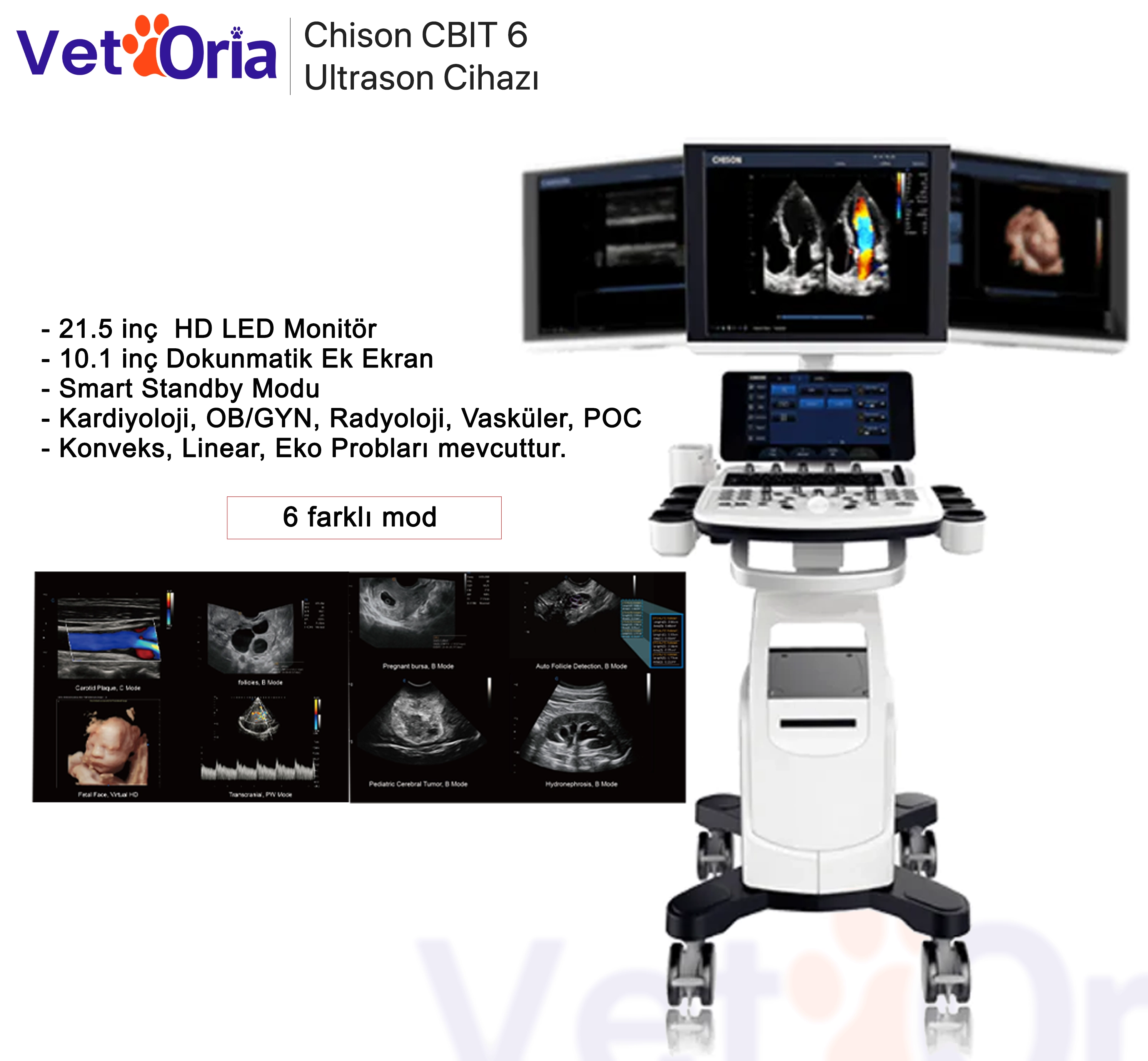 Chison CBIT 6 Ultrason Cihazı
